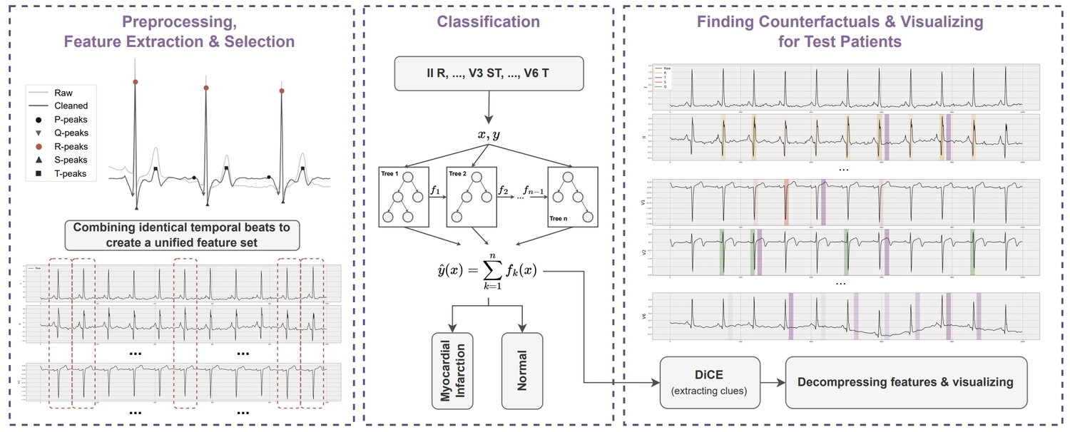 A three-stage pipeline: ECG preprocessing and feature extraction, tree-ensemble classification, then counterfactual generation visualised back on the trace.