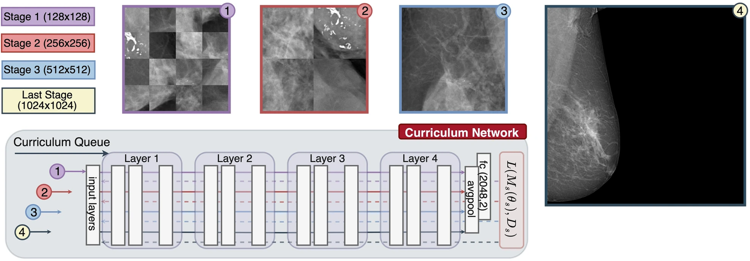 A curriculum from 128-pixel patches through 256 and 512 to the full 1024-pixel mammogram, feeding one network across stages.